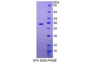 SDS-PAGE (SDS) image for Interleukin 17 Receptor E (IL17RE) (AA 457-630) protein (His tag) (ABIN1877510) (IL17RE Protein (AA 457-630) (His tag))
