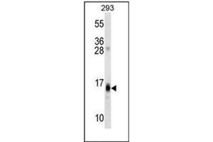 Western blot analysis of RGS8 Antibody (N-term) in 293 cell line lysates (35ug/lane).