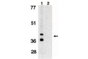 Image no. 1 for anti-BCL2/adenovirus E1B 19kDa Interacting Protein 3-Like (BNIP3L) (AA 77-92) antibody (ABIN264993) (BNIP3L/NIX Antikörper  (AA 77-92))