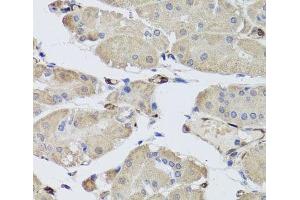 Immunohistochemistry of paraffin-embedded Human stomach using FABP5 Polyclonal Antibody at dilution of 1:100 (40x lens). (FABP5 Antikörper)