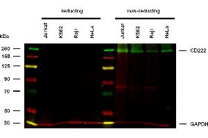 Anti-Hu CD222 Purified (clone MEM-240) works in WB application under non-reducing conditions. (IGF2R Antikörper)