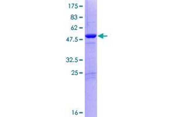 DGCR6L Protein (AA 1-220) (GST tag)