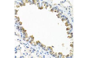 Immunohistochemistry of paraffin-embedded mouse lung using TICAM1 antibody. (TICAM1 Antikörper  (AA 20-200))