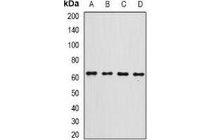 Western blot analysis of Gc-globulin expression in A549 (A), A375 (B), SHSY5Y (C), mouse liver (D) whole cell lysates. (Vitamin D-Binding Protein Antikörper)