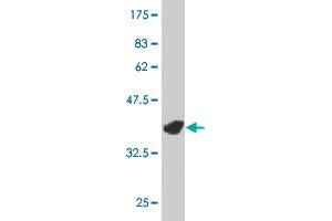 Western Blotting (WB) image for anti-LIM Domain Kinase 1 (LIMK1) (AA 548-647) antibody (ABIN517523)