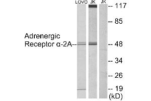 Immunohistochemistry analysis of paraffin-embedded human testis tissue using Adrenergic Receptor α-2A antibody. (ADRA2A Antikörper  (Internal Region))