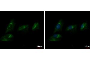 ICC/IF Image Autotaxin antibody detects Autotaxin protein at cytoplasm by immunofluorescent analysis. (ENPP2 Antikörper  (C-Term))