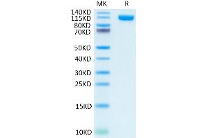 PSMA Protein (AA 44-750) (Fc Tag)