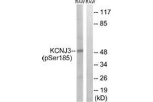 Western blot analysis of extracts from RAW264. (KCNJ3 Antikörper  (pSer185))