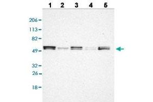 Western blot analysis of Lane 1: RT-4 cell line, Lane 2: U-251MG sp cell line, Lane 3: A-431 cell line, Lane 4: human liver tissue, and Lane 5: human tonsil tissue with LYN polyclonal antibody .