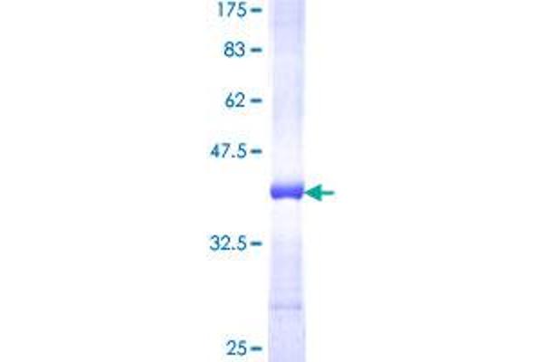 AP3B1 Protein (AA 995-1094) (GST tag)