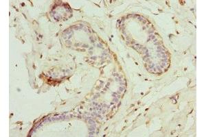 Immunohistochemistry (IHC) image for anti-Glucosaminyl (N-Acetyl) Transferase 2, I-Branching Enzyme (I Blood Group) (GCNT2) (AA 203-402) antibody (ABIN7160702)