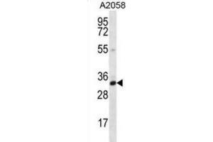 Western Blotting (WB) image for anti-Calponin 2 (CNN2) antibody (ABIN2996730) (CNN2 Antikörper)