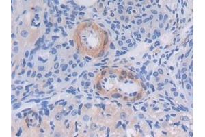 Immunohistochemistry (IHC) image for anti-Thioredoxin Interacting Protein (TXNIP) (AA 30-381) antibody (ABIN7433201)