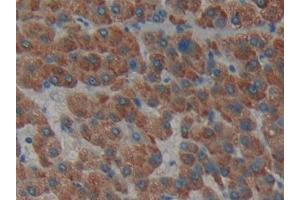 Used in DAB staining on fromalin fixed paraffin- embedded liver tissue (Laminin alpha 1 Antikörper  (AA 2613-2746))