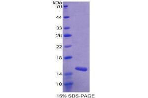 SDS-PAGE (SDS) image for Mucosae Associated Epithelia Chemokine (AA 20-115) protein (His tag) (ABIN2125971)