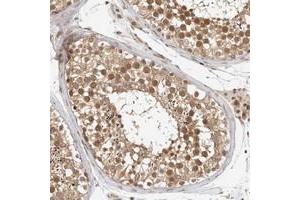Immunohistochemical staining of human testis with ZNF318 polyclonal antibody  shows moderate nuclear and cytoplasmic positivity in cells in seminiferus duct cells. (ZNF318 Antikörper)