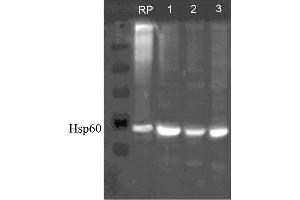 Western Blotting (WB) image for anti-Heat Shock 60kDa Protein 1 (Chaperonin) (HSPD1) antibody (ABIN863186)