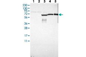 Western blot analysis of Lane 1: RT-4, Lane 2: U-251 MG, Lane 3: Human Plasma, Lane 4: Liver, Lane 5: Tonsil with GAB3 polyclonal antibody . (GAB3 Antikörper)