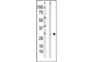 The anti-TK2 Pab (ABIN1882141 and ABIN2841224) is used in Western blot to detect TK2 in HepG2 cell lysate (Lane 1) and mouse liver tissue lysate (Lane 2). (TK2 Antikörper  (N-Term))