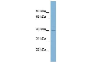 WB Suggested Anti-A4GALT Antibody Titration:  0. (A4GALT Antikörper  (Middle Region))