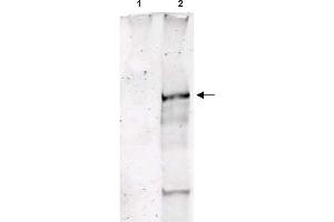 Image no. 1 for anti-Ataxia Telangiectasia Mutated (ATM) (pSer1981) antibody (ABIN401482) (ATM Antikörper  (pSer1981))
