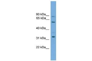 WB Suggested Anti-PTDSS2 Antibody Titration:  0.