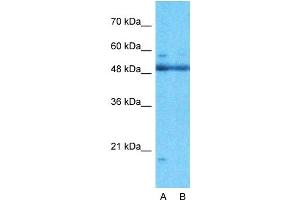 Host:  Rabbit  Target Name:  ARID5A  Sample Type:  721_B  Lane A:  Primary Antibody  Lane B:  Primary Antibody + Blocking Peptide  Primary Antibody Concentration:  1ug/ml  Peptide Concentration:  5ug/ml  Lysate Quantity:  25ug/lane/lane  Gel Concentration:  0.