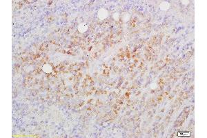 Formalin-fixed and paraffin embedded mouse lymphoma labeled with Rabbit Anti-CD82/KAI1 Polyclonal Antibody, Unconjugated  at 1:200 followed by conjugation to the secondary antibody and DAB staining (CD82 Antikörper  (AA 165-267))