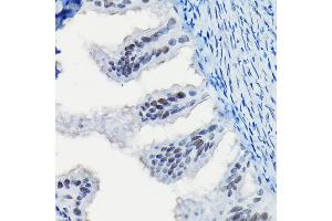 Immunohistochemistry of paraffin-embedded rat fallopian tube using Progesterone Receptor Rabbit pAb (ABIN6128570, ABIN6145518, ABIN6145519 and ABIN6213802) at dilution of 1:100 (40x lens). (Progesterone Receptor Antikörper  (AA 1-250))