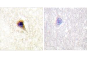 P-peptide - +Immunohistochemical analysis of paraffin-embedded human brain tissue using FAK (Phospho-Tyr576) Antibody (#A0426). (FAK Antikörper  (pTyr576))