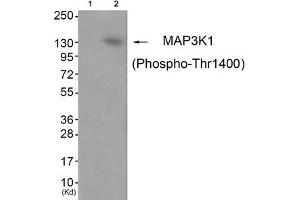 Western blot analysis of extracts from JK cells (Lane 2), using MAP3K1 (Phospho-Thr1400) Antibody. (MAP3K1 Antikörper  (pThr1402))
