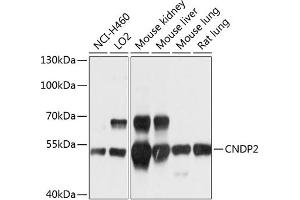 Western blot analysis of extracts of various cell lines, using CNDP2 antibody (ABIN6127642, ABIN6138771, ABIN6138772 and ABIN6214618) at 1:1000 dilution. (CNDP2 Antikörper  (AA 1-210))