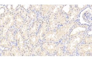 Immunohistochemistry (IHC) image for anti-Receptor Tyrosine Kinase-Like Orphan Receptor 1 (ROR1) (AA 540-795) antibody (ABIN7439615)