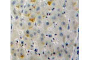 Used in DAB staining on fromalin fixed paraffin-embedded Liver tissue (CD79b Antikörper  (AA 37-226))