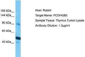 Host: Rabbit Target Name: PCDHGB5 Sample Type: Thymus Tumor lysates Antibody Dilution: 1. (PCDHGB5 Antikörper  (Middle Region))