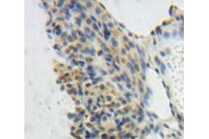 Used in DAB staining on fromalin fixed paraffin-embedded Ovary tissue (GTF2E1 Antikörper  (AA 15-306))