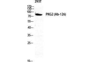 Western Blot (WB) analysis of 293T cells using cGKII Polyclonal Antibody. (PRKG2 Antikörper  (Ser363, Thr359))