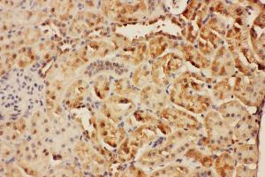 Anti-CISH antibody, IHC(P) IHC(P): Rat Kidney Tissue