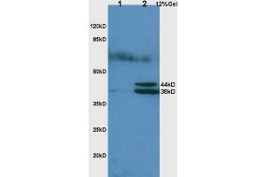L1 rat lung lysates L2 rat liver lysates probed with Anti Hpt/Haptoglobin Polyclonal Antibody, Unconjugated (ABIN734738) at 1:200 in 4 °C. (Haptoglobin Antikörper  (AA 251-350))
