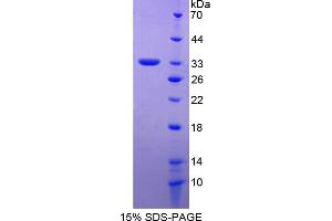 Image no. 1 for Amyloid beta (A4) Precursor Protein-Binding, Family A, Member 2 (APBA2) (AA 459-722) protein (His tag) (ABIN4989641) (APBA2 Protein (AA 459-722) (His tag))