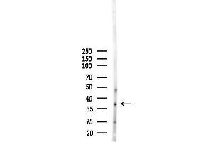 anti-Microtubule Associated serine/threonine Kinase 4 (MAST4) (N-Term) antibody