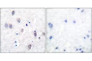 Immunohistochemistry analysis of paraffin-embedded human brain, using Amyloid beta A4 (Ab-743/668) Antibody. (APP Antikörper  (AA 711-760))