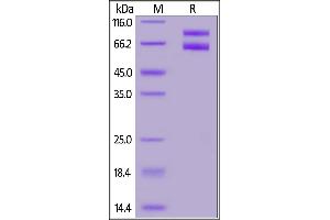 Human IL-2RB&IL-2RG Heterodimer Protein, Fc Tag&Fc Tag (MALS verified) on  under reducing (R) condition. (IL-2 R beta & IL-2 R gamma (AA 27-239) (Active) protein (Fc Tag))