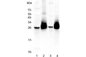 Western blot testing of 1) mouse brain, 2) (m) thymus, 3) (m) lung, and 4) rat thymus lysate with CD90 antibody. (CD90 Antikörper)