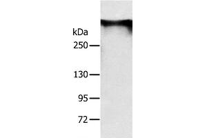 Western Blot analysis of Mouse brain tissue using RYR1 Polyclonal Antibody at dilution of 1:300 (RYR1 Antikörper)