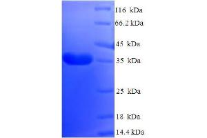 SDS-PAGE (SDS) image for DPY30 Domain Containing 2 (DYDC2) (AA 1-177), (full length) protein (His-SUMO Tag) (ABIN5711563) (DYDC2 Protein (AA 1-177, full length) (His-SUMO Tag))