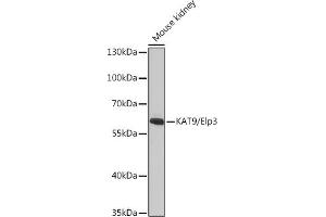 Western blot analysis of extracts of Mouse kidney, using K/K/Elp3 antibody (ABIN6130883, ABIN6140142, ABIN6140143 and ABIN6225217) at 1:1000 dilution. (ELP3/KAT9 Antikörper  (AA 358-547))