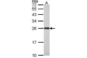 Western Blotting (WB) image for anti-NADH Dehydrogenase (Ubiquinone) Fe-S Protein 8, 23kDa (NADH-Coenzyme Q Reductase) (NDUFS8) (Center) antibody (ABIN2856948)
