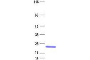 Validation with Western Blot (LCNL1 Protein (His tag))